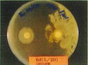 大腸菌実験写真